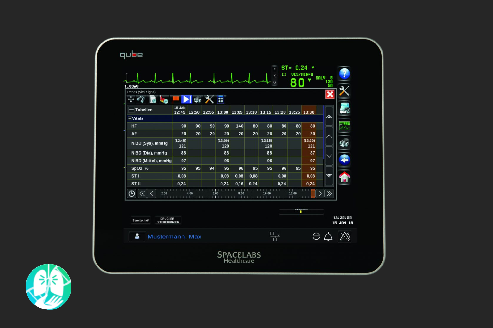 Monitor de Signos Vitales Spacelabs Modelo Qube