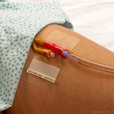 Sujetador para Cáteter Foley Dale Medical